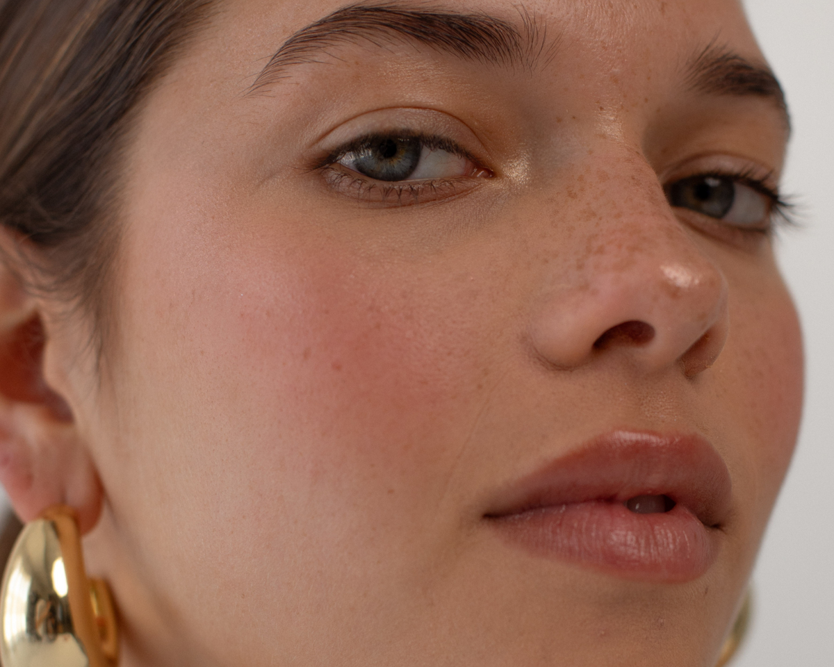 <br>Will Botox make me look <span style="font-style: italic;">frozen?</span>